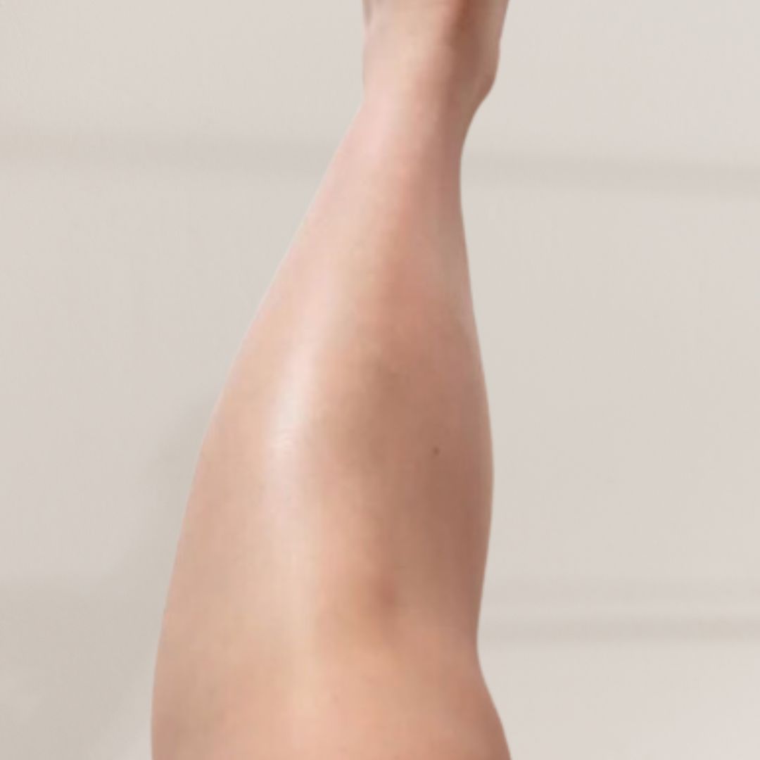 apres épilation définitive (17)