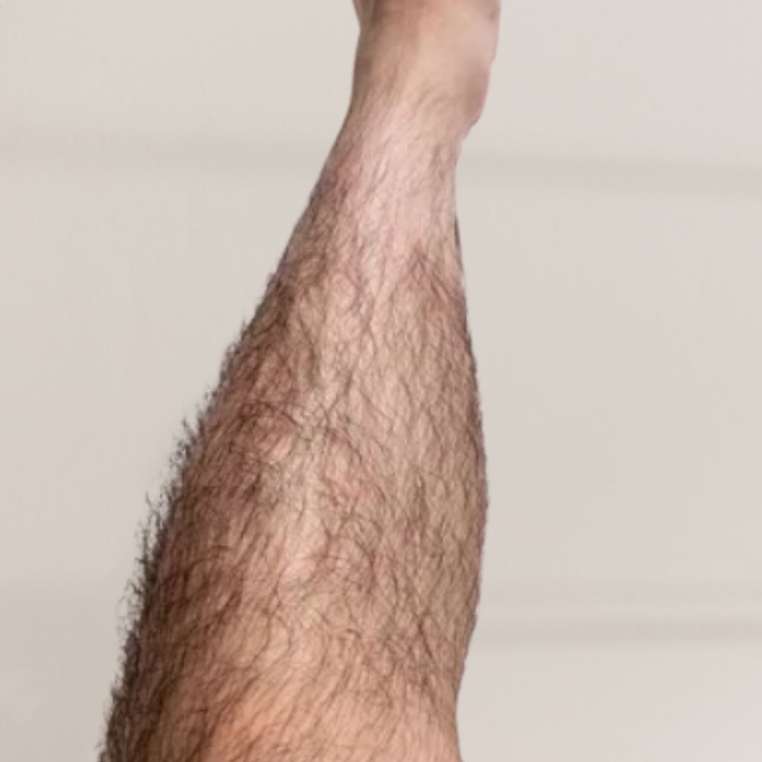 avant épilation définitive (19)