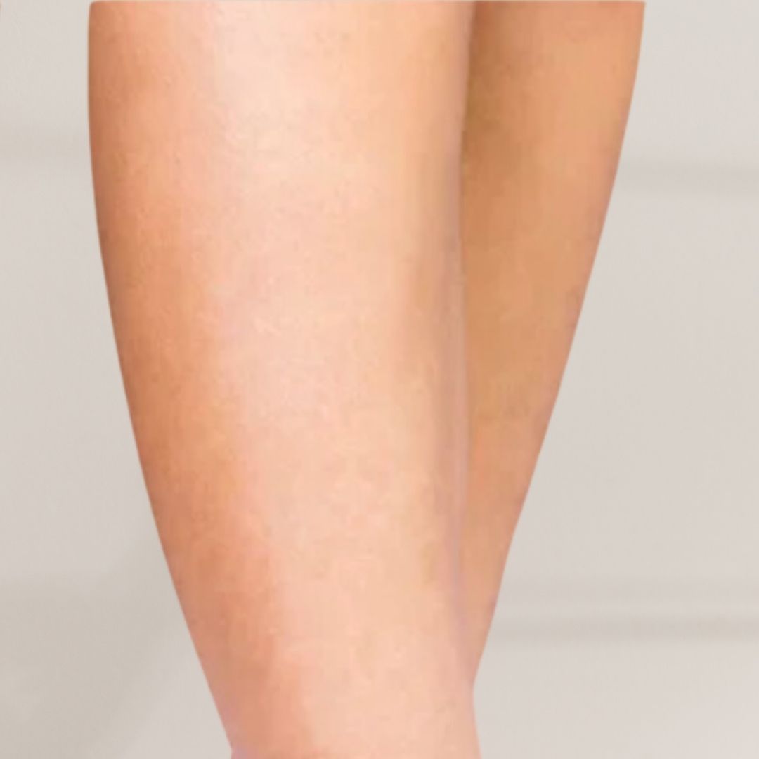 apres épilation définitive (15)