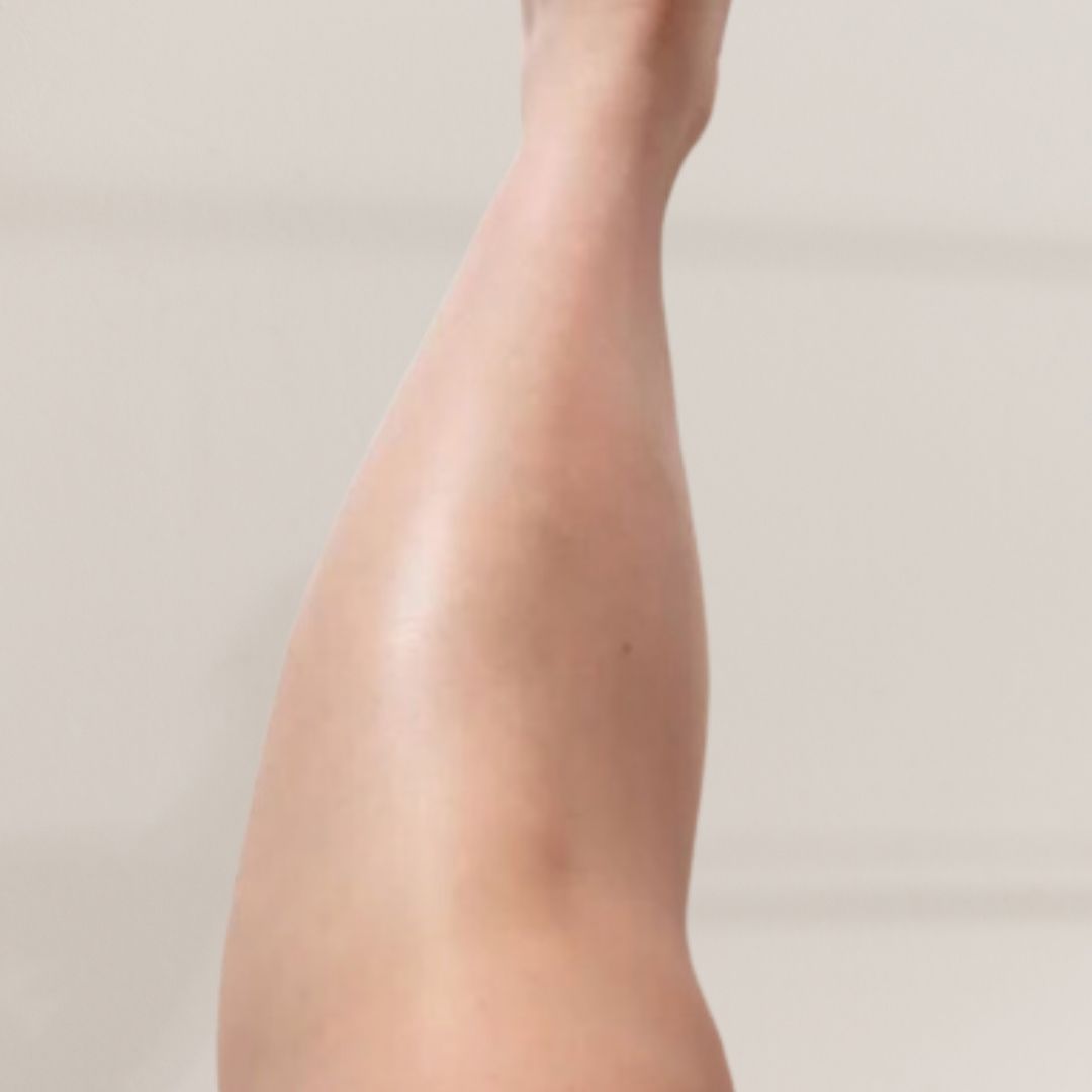 apres épilation définitive (17)