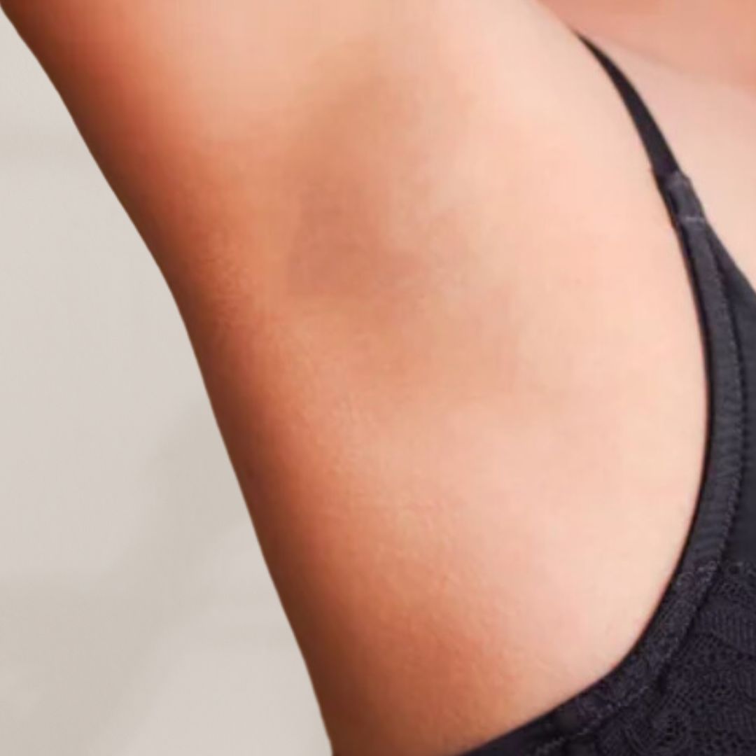 apres épilation définitive (3)