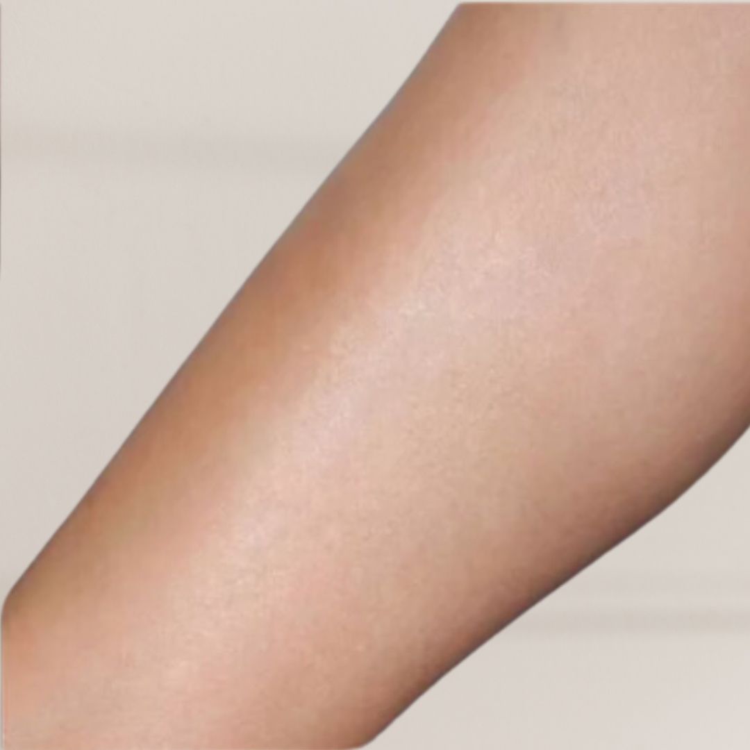 apres épilation définitive (9)